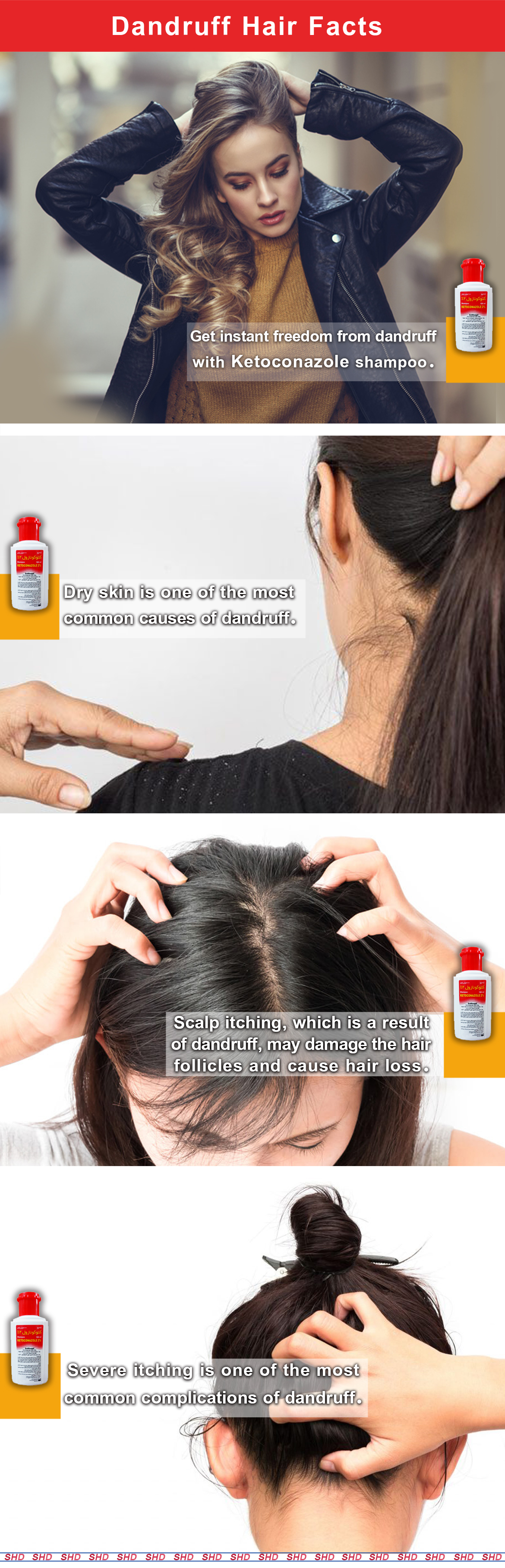 Get instant freedom from dandruff with Ketoconazole shampoo